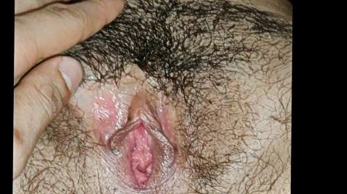 - Privatporno